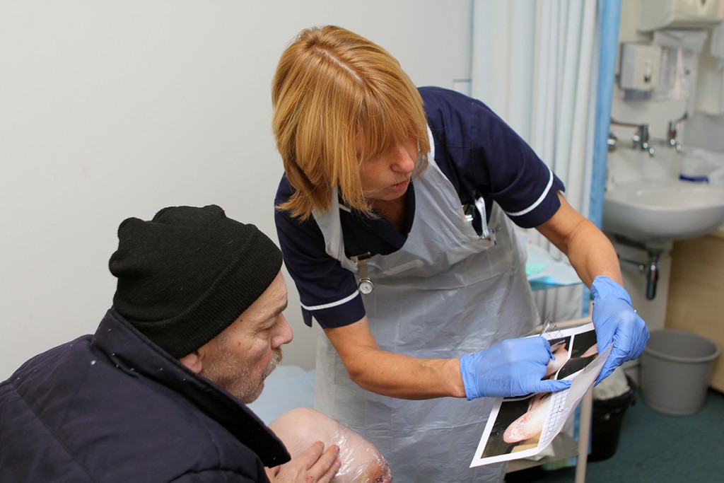 wound care sue_large